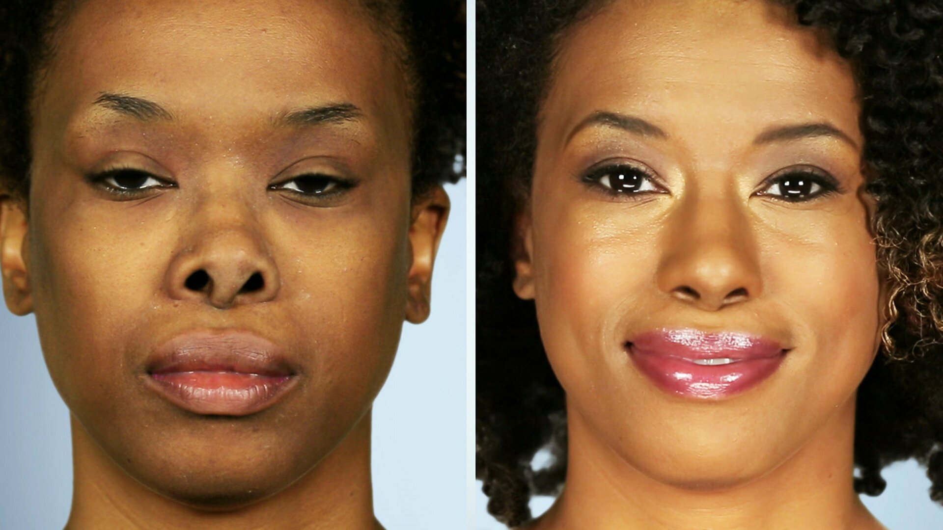 Botched - Desastres do Bisturi : Top 10 dos Antes e Depois Mais Impressionantes