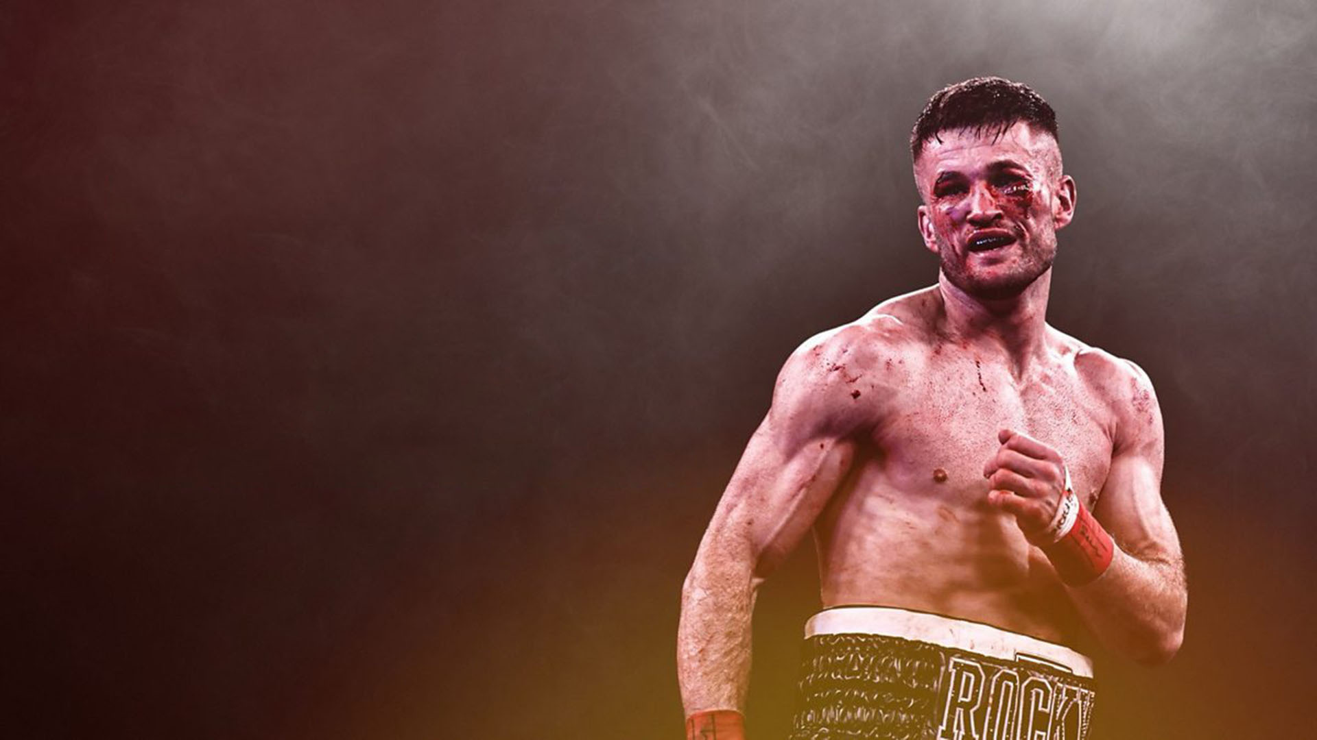 Gloves Are Off: The Rise Of Bare-Knuckle Boxing