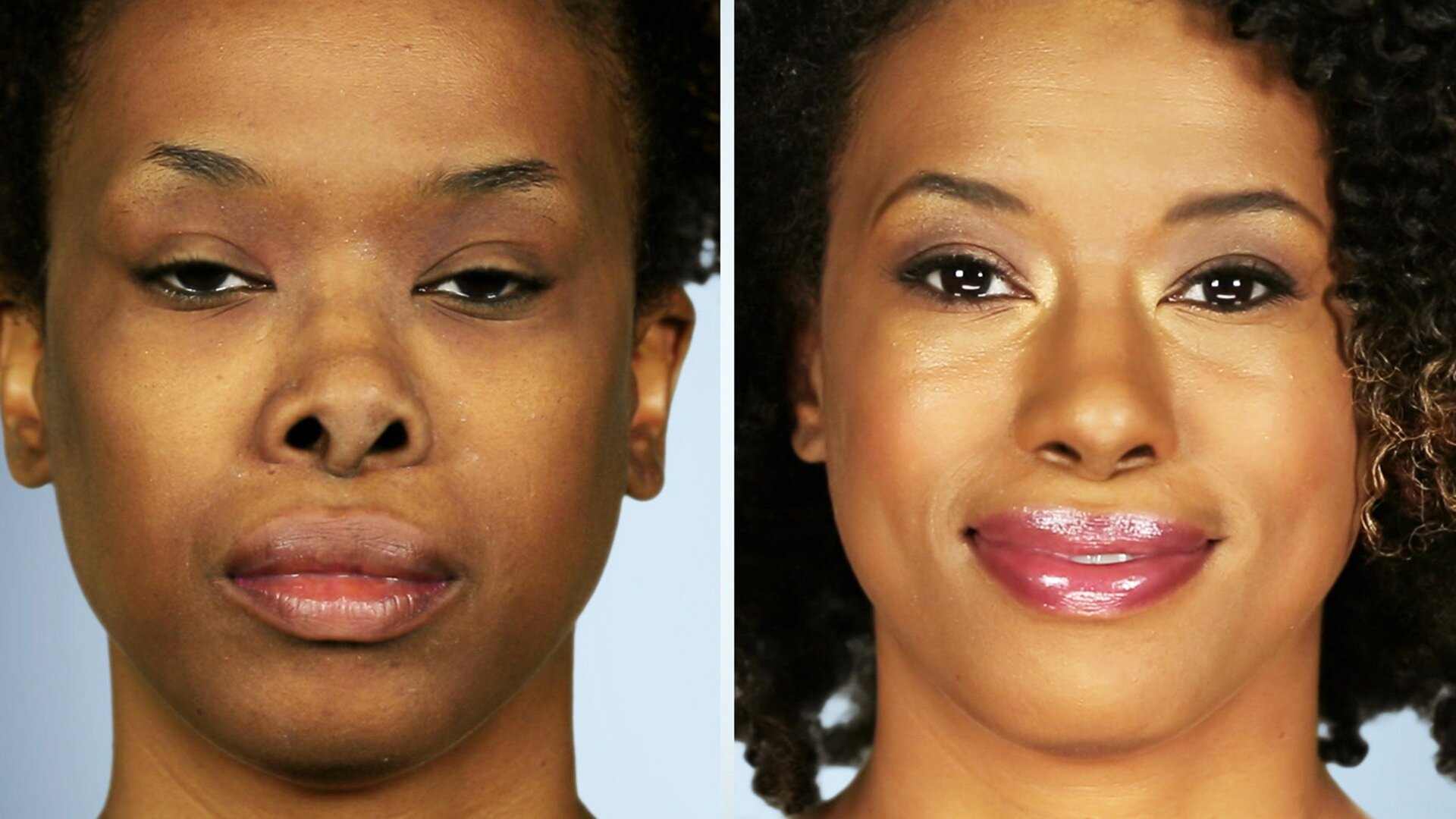 Botched - Desastres do Bisturi : Top 10 dos Antes e Depois Mais Impressionantes